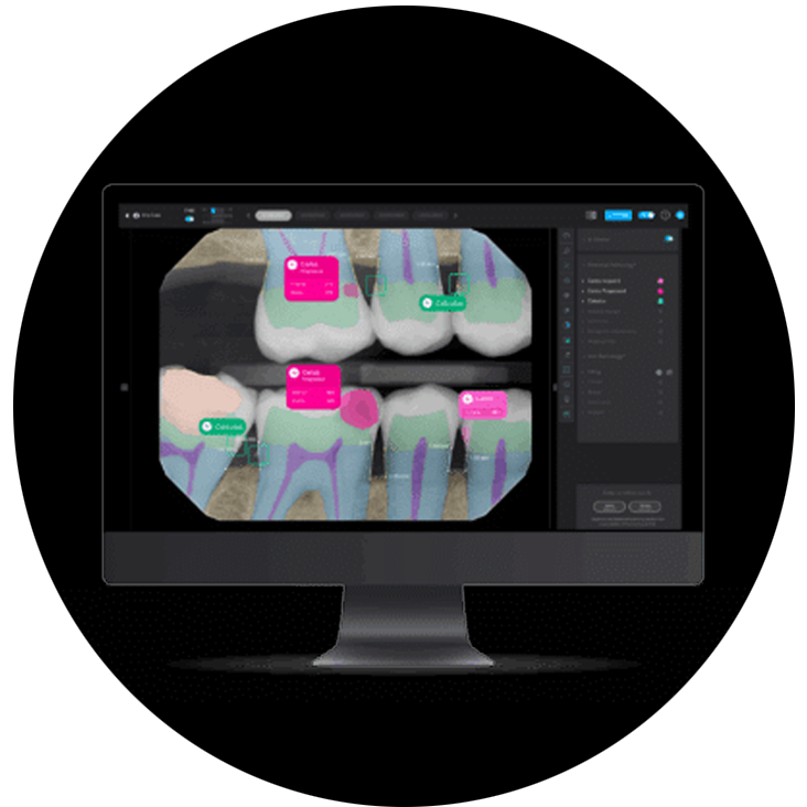 invisalign-shepperton-dentla